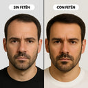 Antes y después de usar los productos de FETĒN, combate la caída del cabello, ojeras, bolsas, arrugas, imperfecciones y piel apagada