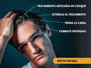 Tratamiento de choque contra la caída del pelo y la alopecia en hombres, estimula el crecimiento del cabello y frena la caída